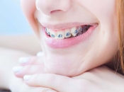 替牙期常見的牙齒不整齊有哪幾種？