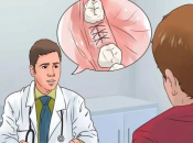 剝牙期間嘅用藥安全，阿司匹林同華法林是否需要停藥？