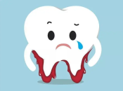 牙周炎病人可以裝假牙嗎？上深圳治療牙周病掂唔掂？