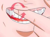 牙齒鬆動應該如何處理？深圳牙醫話千祈唔好隨意剝牙！