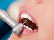 深圳補牙後有咩方法可以緩解牙齒酸軟？ 