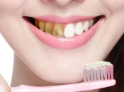 導致氟牙症嘅原因有邊啲？應該點樣預防氟斑牙？