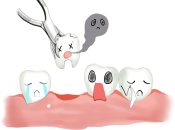 牙痛時是否能夠上深圳剝牙？