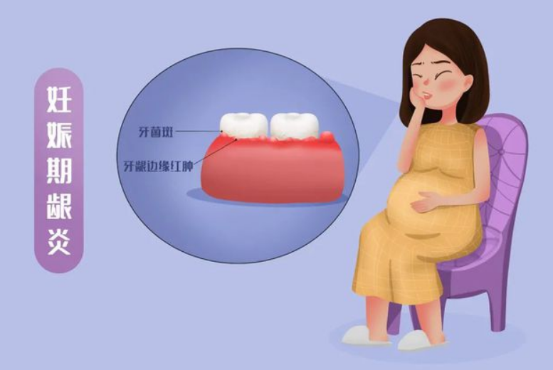 深圳牙周治療-妊娠期間牙齒出血怎麼辦呢？