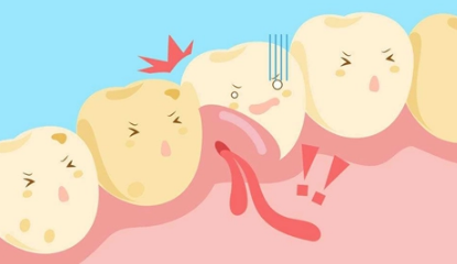 深圳牙周治療——急性牙齦炎有什麼分類呢？