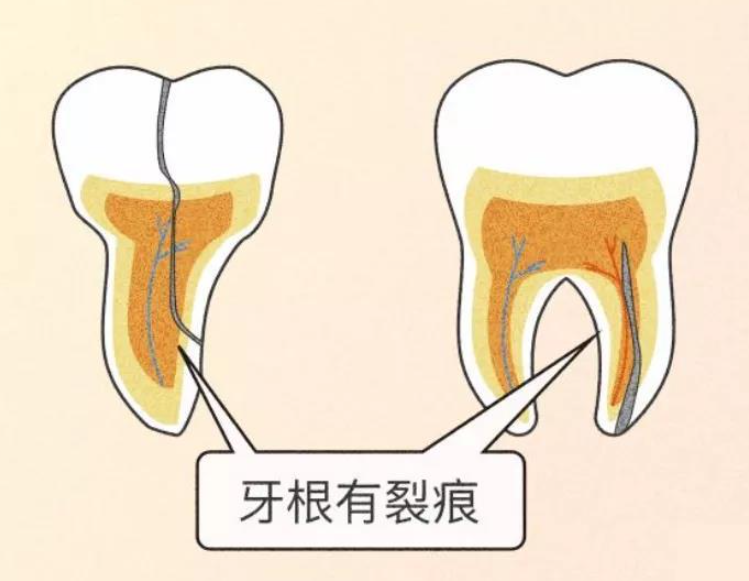 深圳杜牙根