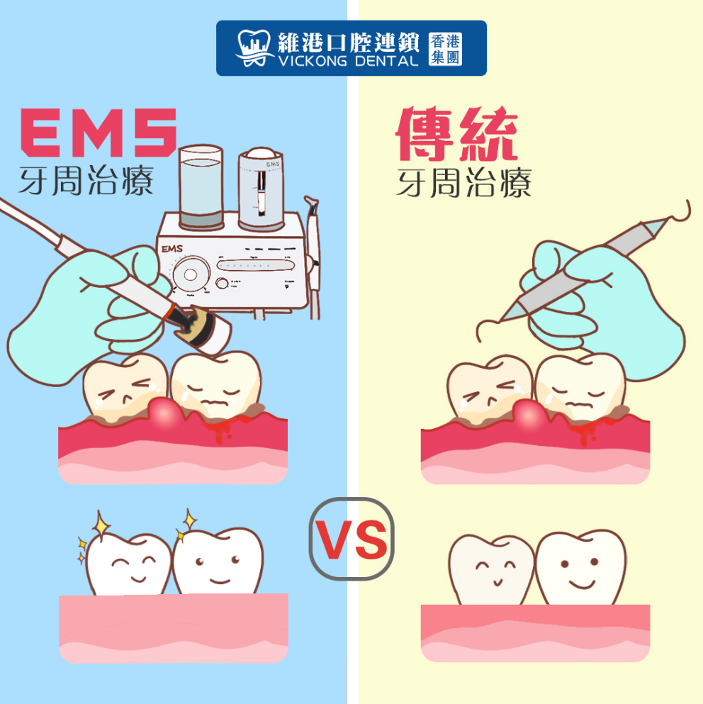 深圳牙周治療