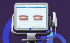 iTero口內數位化掃描應用——隱適美隱形矯正醫生陳何熙