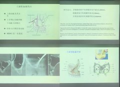 維港口腔種植牙醫生受邀參加登騰高級專家研討會