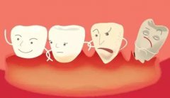 深圳牙周治療-哪些不良習慣可能會引發牙周炎呢？
