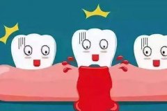 牙周疾病會傳染、遺傳嗎？