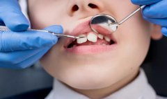 什麼是牙頷畸形，我國少年兒童牙頜畸形發病率 是多少？