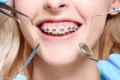 牙頜畸形的危害有牌些，如何預防？