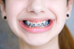 牙頷畸形矯正前應作哪些檢査和治療？
